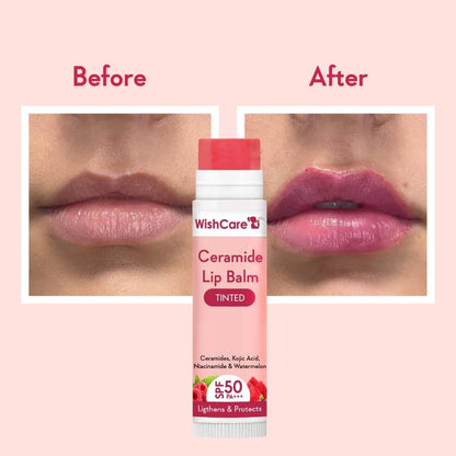 WishCare Lip Lightening Balm SPF50+ - Kojic Acid & Niacinamide