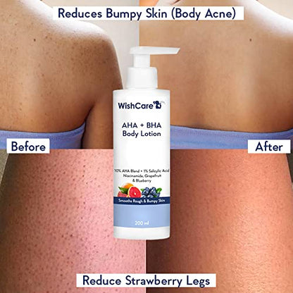 WishCare 10% AHA + 1% BHA Body Lotion: Exfoliate & Smooth Rough Skin