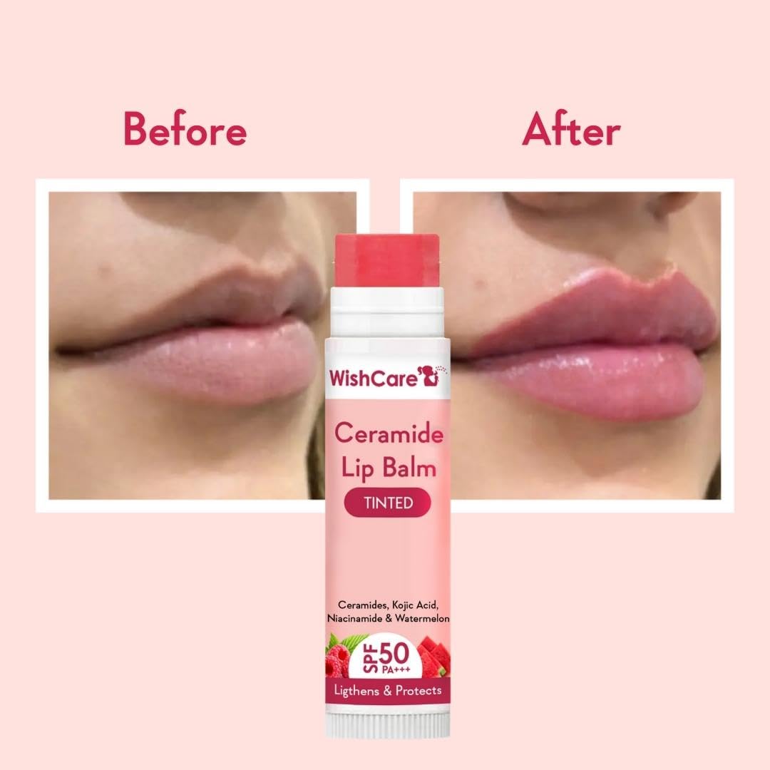 WishCare Lip Lightening Balm SPF50+ - Kojic Acid & Niacinamide