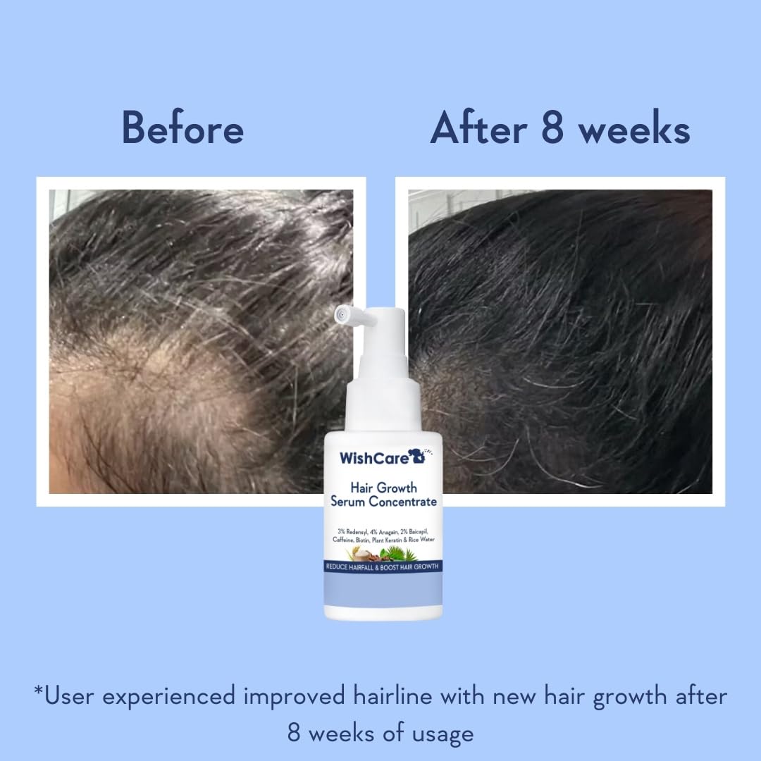 Hair Growth Serum - Redensyl, Anagain, Caffeine, Biotin