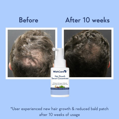 Hair Growth Serum - Redensyl, Anagain, Caffeine, Biotin